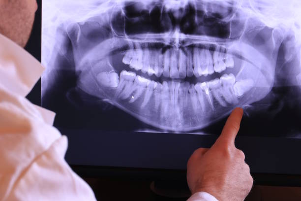 Best Dental Abscess Treatment in Point Pleasant, NJ